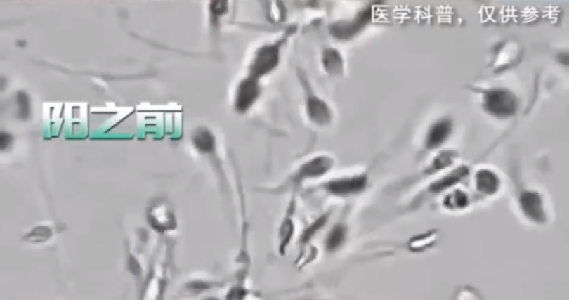 陽康后，多久能過正常性生活