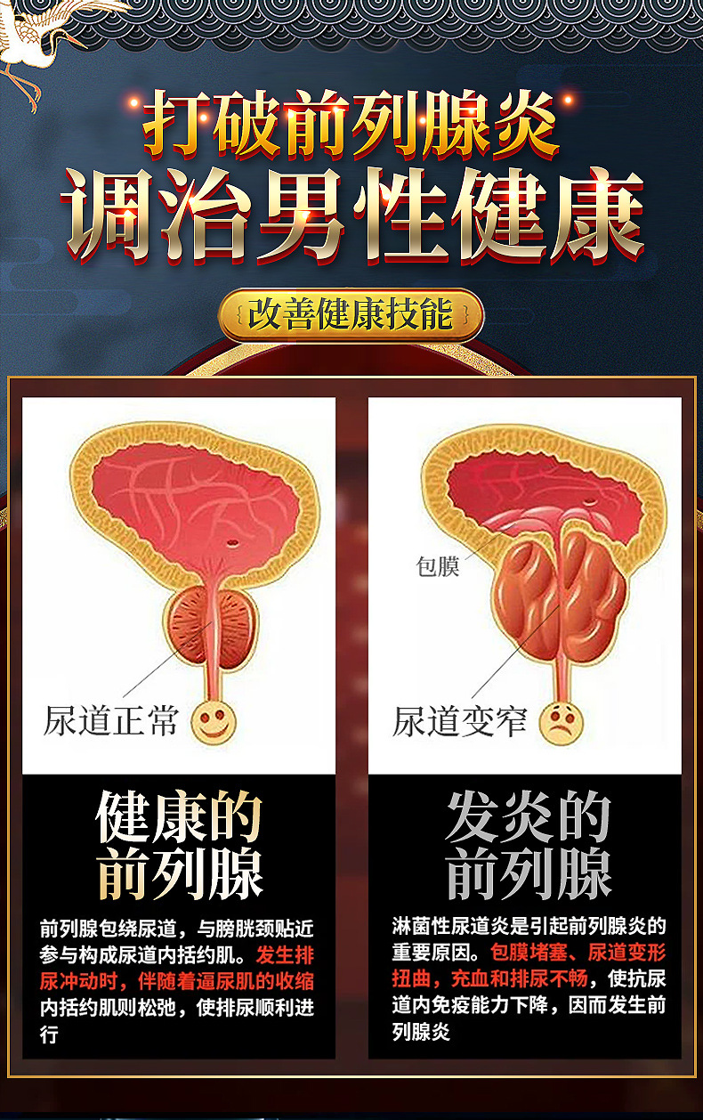 趣愛閣-成人用品店延時(shí)噴劑：interest前列舒3貼延時(shí)噴劑