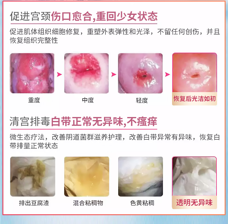 趣愛閣-性用品專賣店助情催情：interest女性10粒縮陰丹助情催情