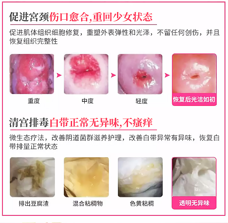 趣愛閣-情趣用品專賣店助情催情：interest醫用敷料婦科凝膠圖助情催情