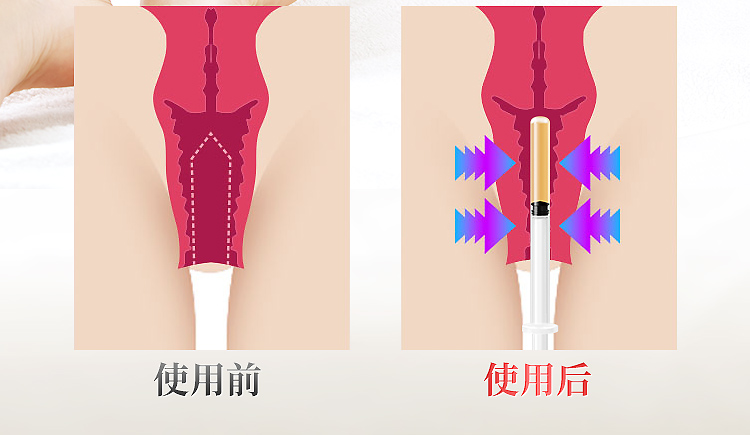 趣愛閣-情趣用品專賣店助情催情：interest醫用敷料婦科凝膠圖助情催情
