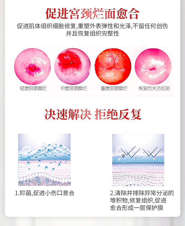 趣愛閣-情趣用品專賣店助情催情：interest醫用敷料婦科凝膠圖助情催情